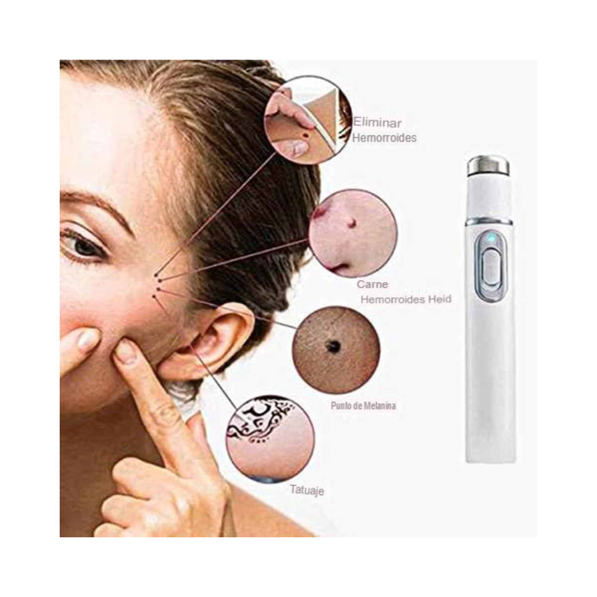 Removedor extractor de puntos negros